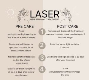 laser hair removal