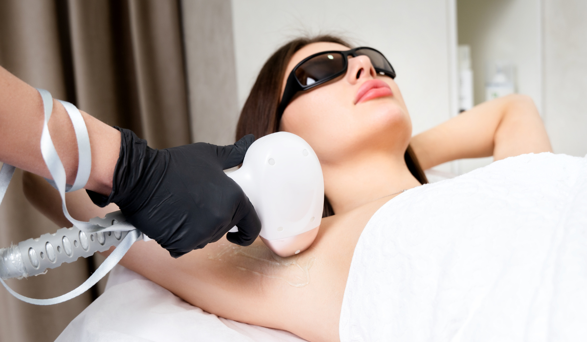 laser hair removal